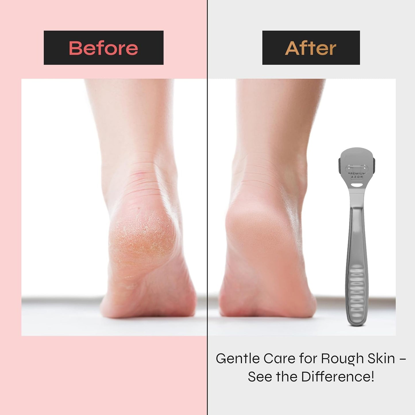 Trendy Look Foot pedicure callus shaver remover hard skin remover
