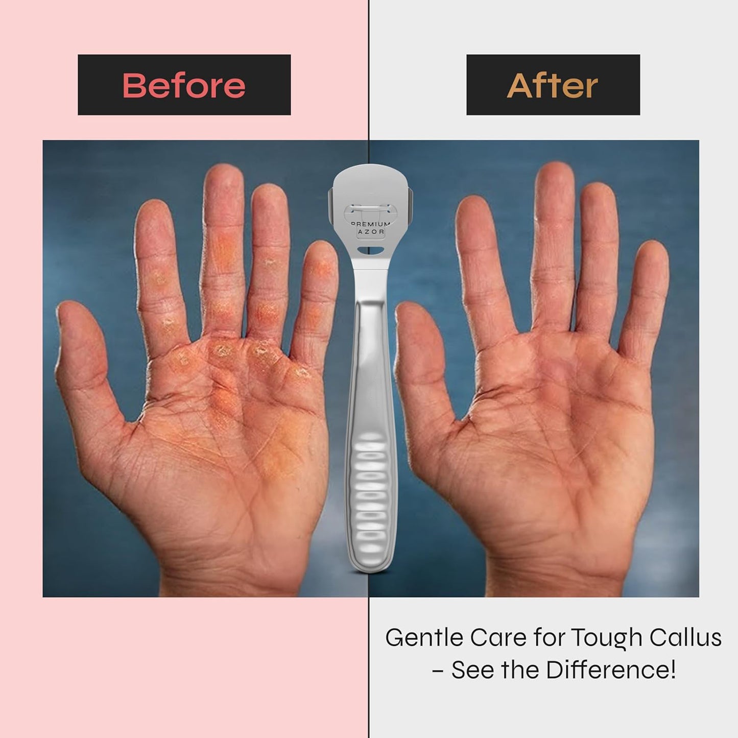 Trendy Look Foot pedicure callus shaver remover hard skin remover