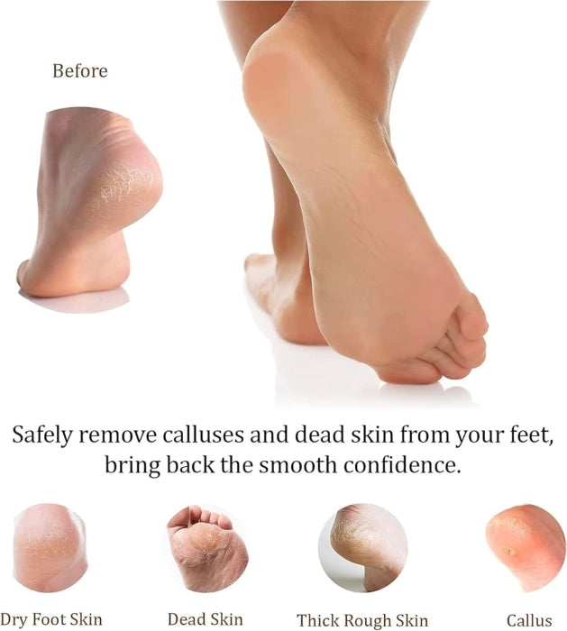 Professional Foot File Callus Remover – Stainless Steel Pedicure Rasp for Cracked Heels | Bite Instruments (Sialkot, Pakistan)