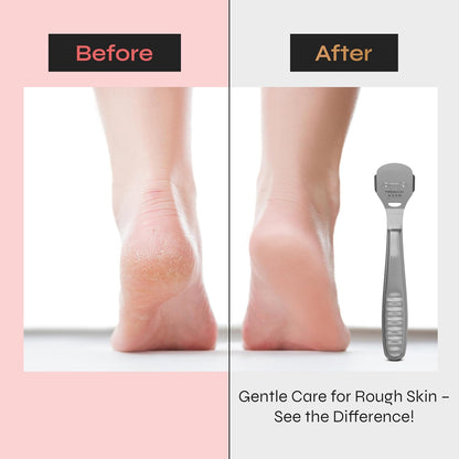 Trendy Look Foot pedicure callus shaver remover hard skin remover