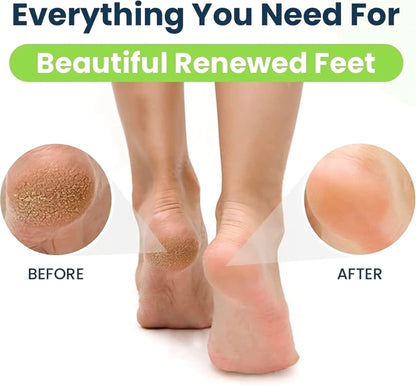 Professional Foot File Callus Remover – Stainless Steel Pedicure Rasp for Cracked Heels | Bite Instruments (Sialkot, Pakistan)