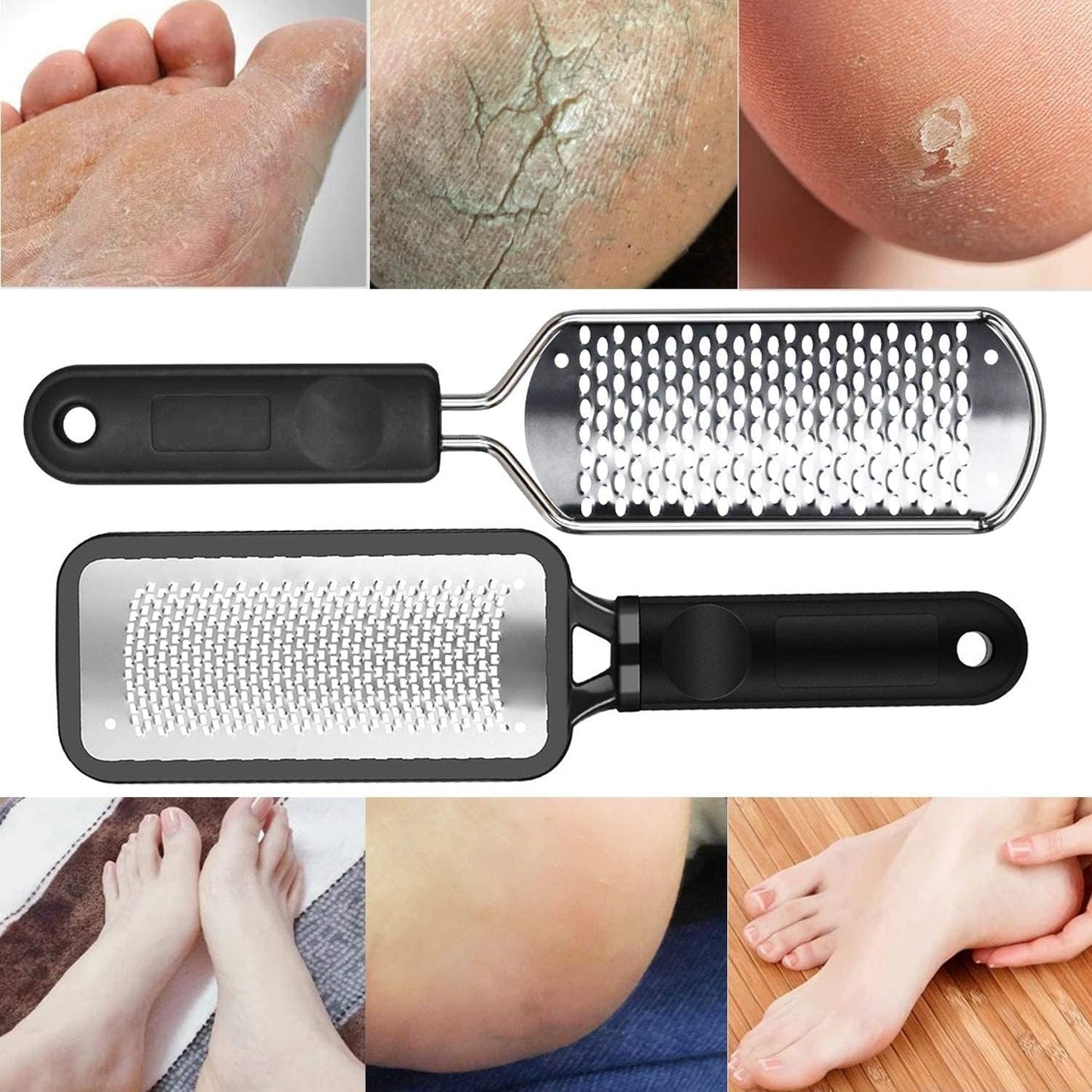 Bite Instruments Foot File – Callus Remover Pedicure Tool for Smooth Feet