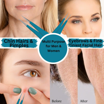 Bite Instruments Sharp Pointed Tweezers Precision Fine Point Tip Ingrown Hair Removal Kit